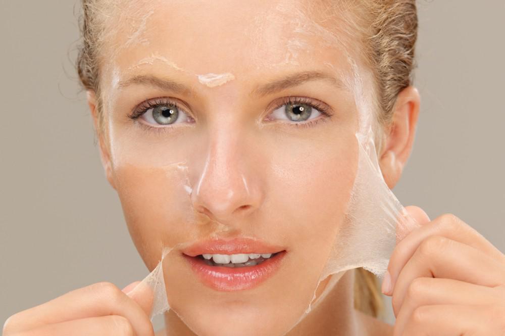 3 Chemical peels