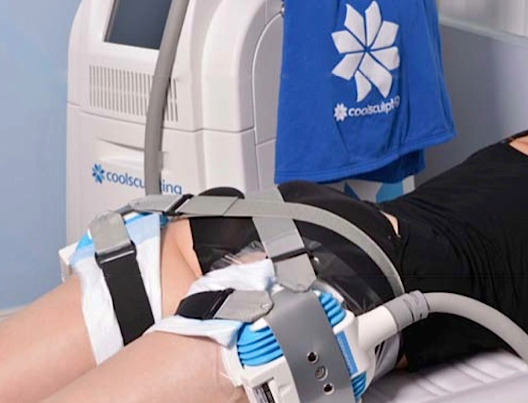 CoolSculpting® Outer thighs 4 Cycles