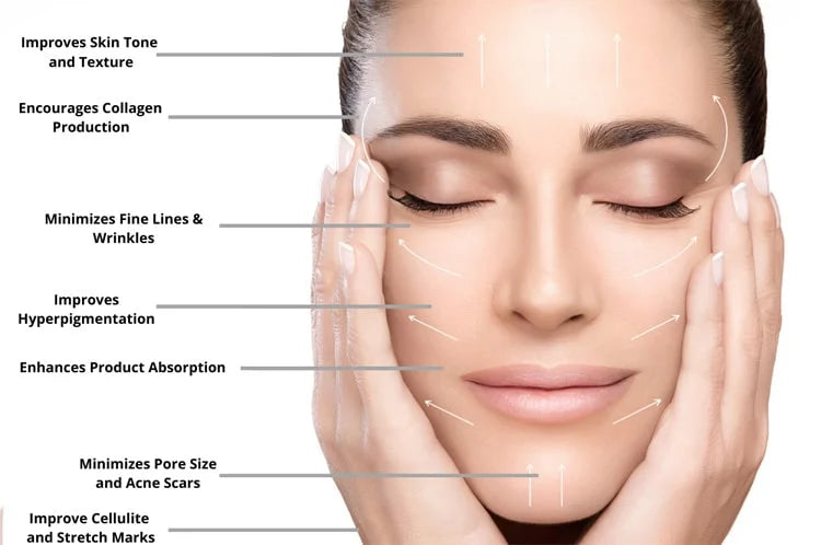 1 SESSION MICRONEEDLING