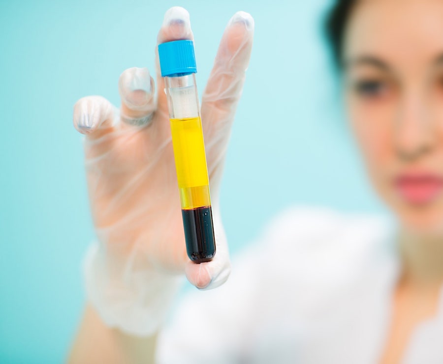 3 SESSIONS PRP (VAMPIRE FACIAL OR HAIR GROWTH)