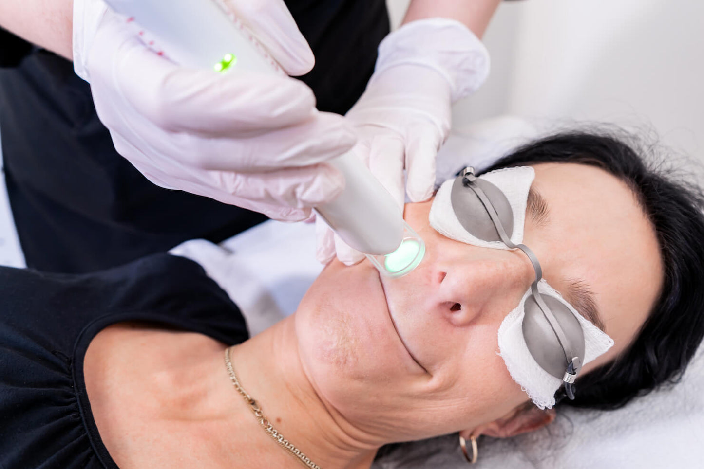 Bikini Laser Hair Removal (Medium area pkg of 6)