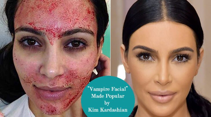 3 SESSIONS PRP (VAMPIRE FACIAL OR HAIR GROWTH)
