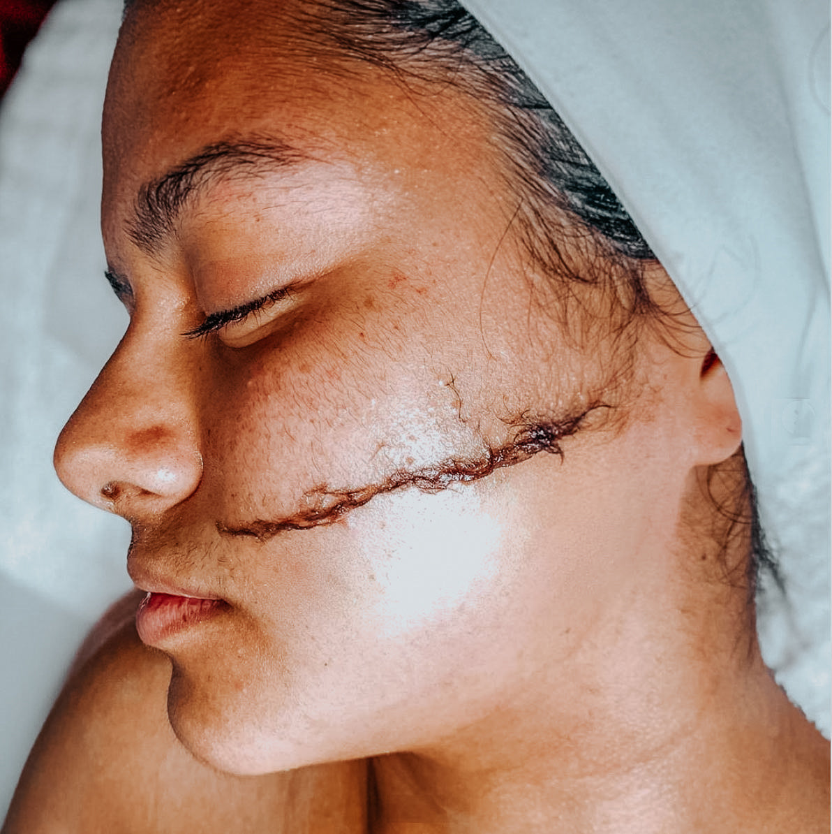 Dew and Renew Facial ( Dermaplaning Facial)