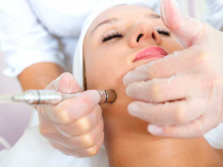 1 Chemical Peel +1  Free Microdermabrasion