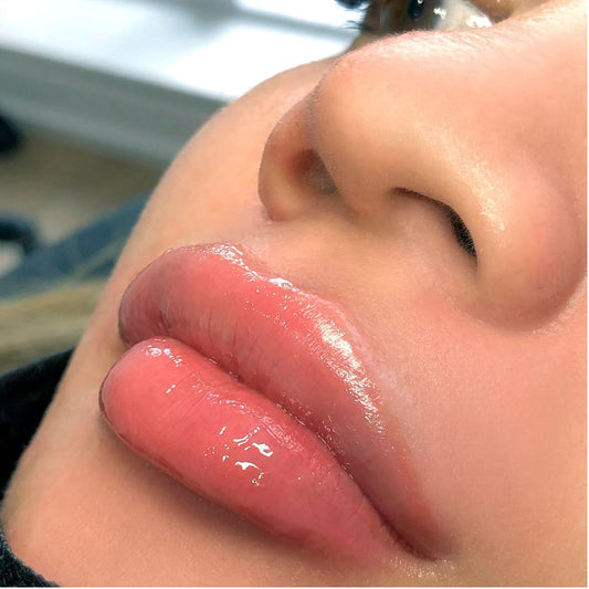 Lip filler 1 syringe Juvederm Ultra Plus XC (not shipped, clinic use only)