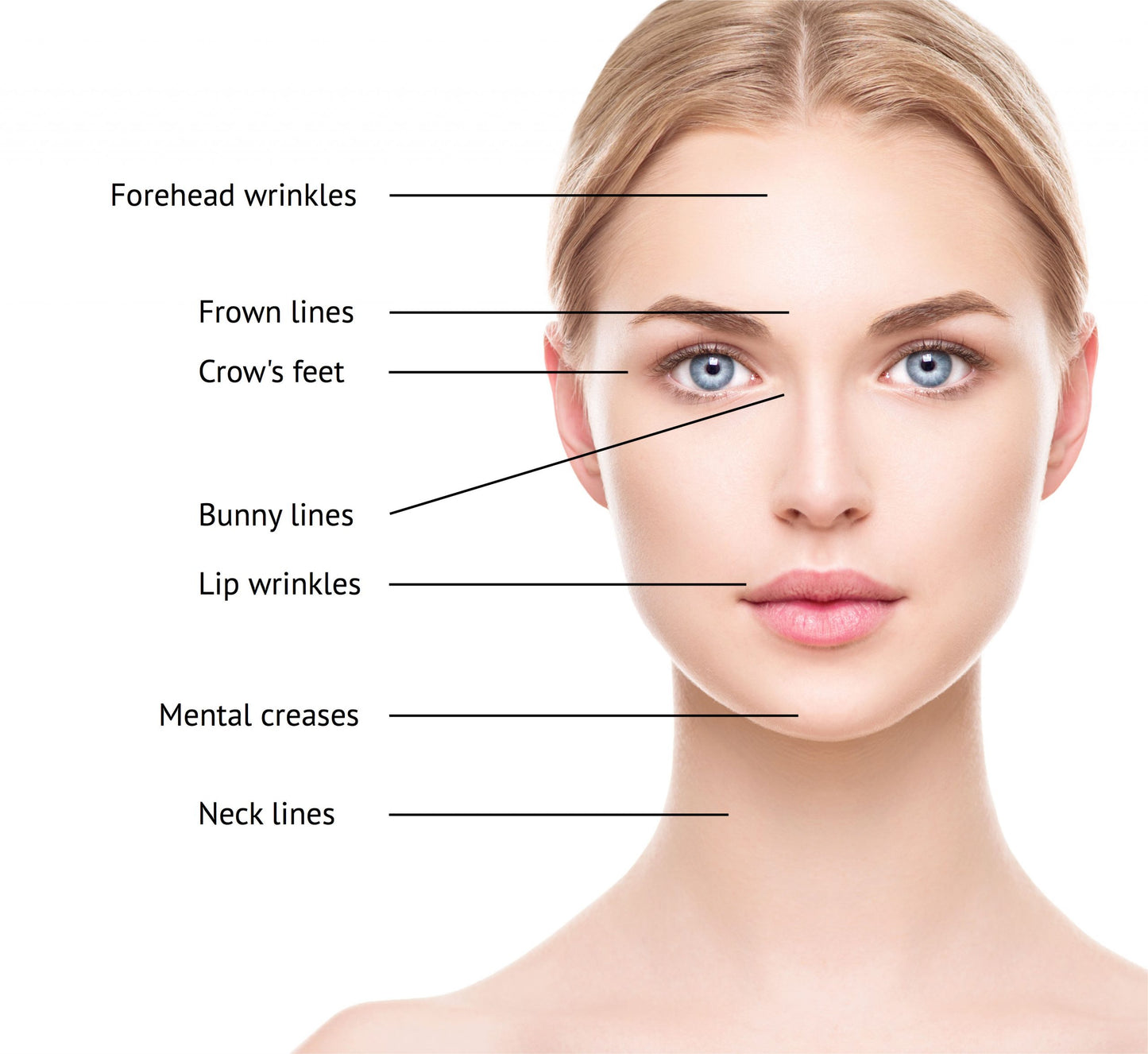 Botox service 50 Units (Not shipped, clinic use only)