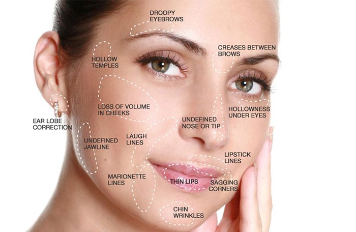 Liquid Facelift  (6 syringes of filler) not to be shipped. Clinic use only